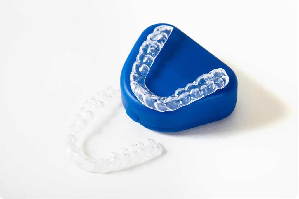 Clear aligners treatment at Dentaura