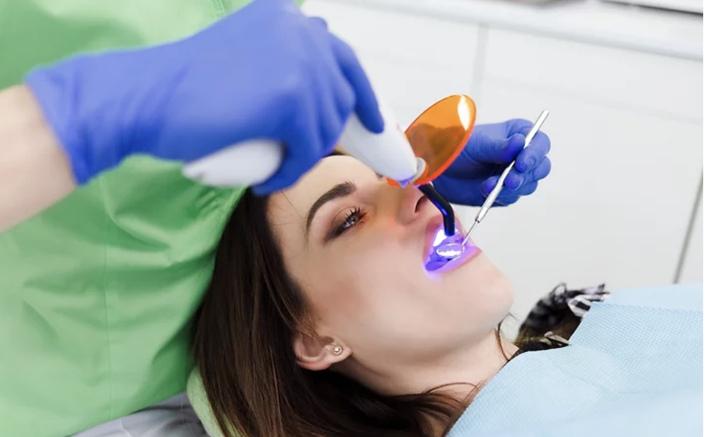 Composite filling curing light treatment at Dentaura